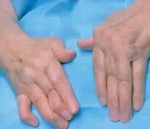 穿好奶奶织的毛裤,你依旧无法避免与风湿膏药共度晚年