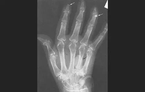 穿好奶奶织的毛裤,你依旧无法避免与风湿膏药共度晚年