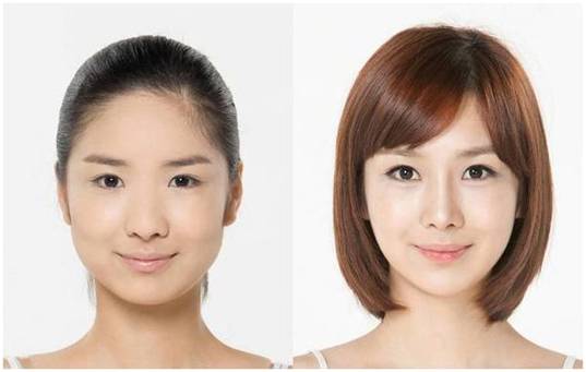 玻尿酸是瘦脸还是填充,玻尿酸填充脸颊会有提拉效果吗