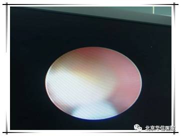 泌尿外科精彩案例,中医男科清道夫