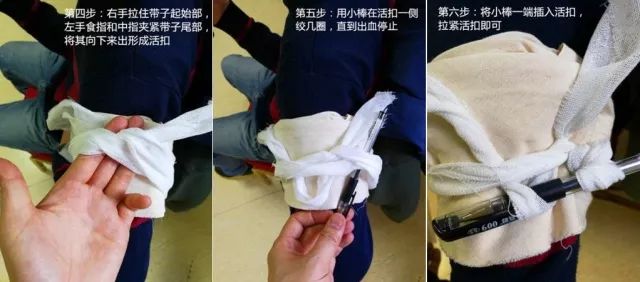 伤口出血可以用卫生巾止血吗,伤口出血怎么包扎好