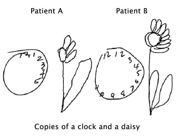 死亡是什么,死亡到底是意味着什么