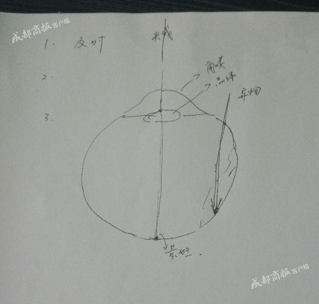男子被铁片击中眼睛,一男子被铁片击中颈动脉大出血