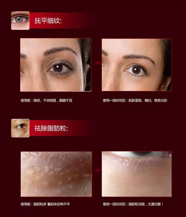 伊思红参蜗牛滚珠眼霜真伪,伊思红参蜗牛滚珠眼霜价格