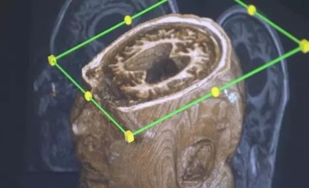 死亡是什么,死亡到底是意味着什么