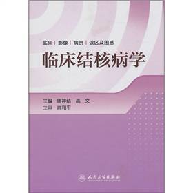 抗结核药对胎儿影响,有没有孕妇能用的抗结核药