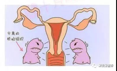 孕妇营养不良又吃不下怎么办,孕妇饮食不均衡应该补充什么