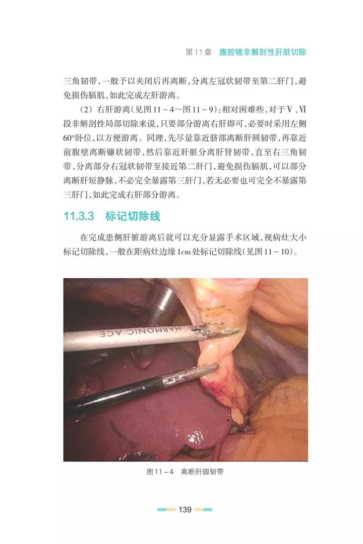 实用肝脾外科学书籍,实用肝脏外科学书籍