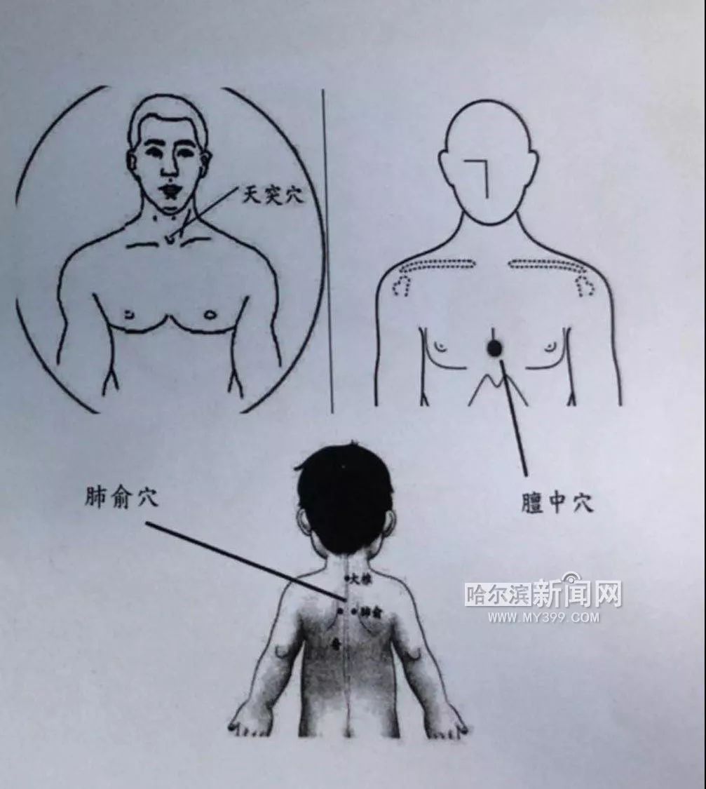 多大孩子适合贴三九贴,穴位贴敷治疗贴婴儿一天几次