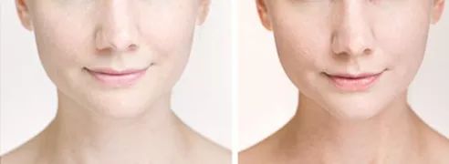 十斤红糖不如一口铁元，拯救黄脸婆全靠它了