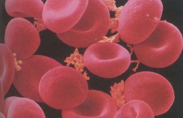 十斤红糖不如一口铁元，拯救黄脸婆全靠它了