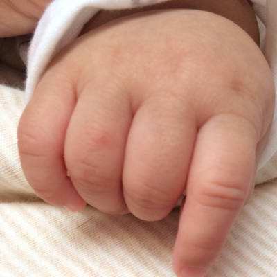 孩子吃药过敏了怎么确认没事了,医院开的药导致孩子过敏