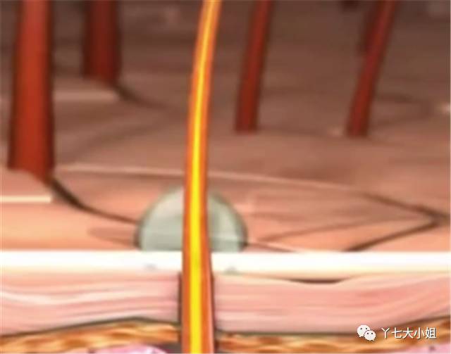 掉发问题我该怎么拯救我的头发,严重掉发头发越来越稀疏不要慌