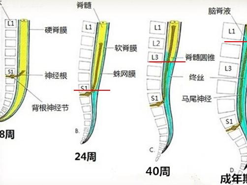 脊髓栓系综合征要做什么检查,脊髓栓系综合征要手术吗