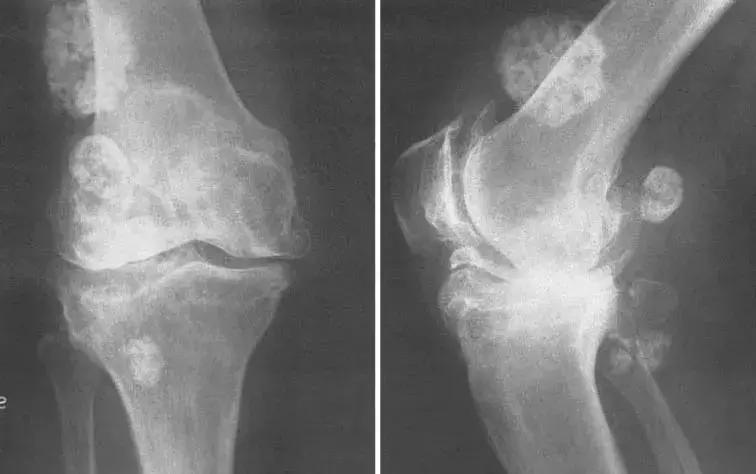 穿好奶奶织的毛裤,你依旧无法避免与风湿膏药共度晚年