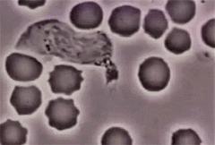 穿好奶奶织的毛裤,你依旧无法避免与风湿膏药共度晚年