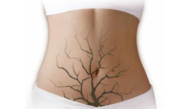 女性白带过少中药调理,女性月经过少怎么调理