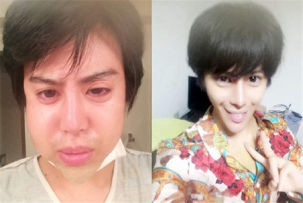 整容最狠的10位男生,盘点整容男