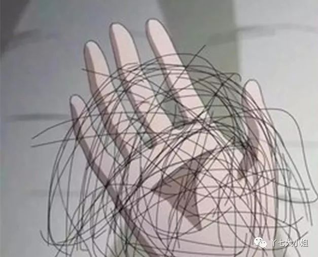 掉发问题我该怎么拯救我的头发,严重掉发头发越来越稀疏不要慌