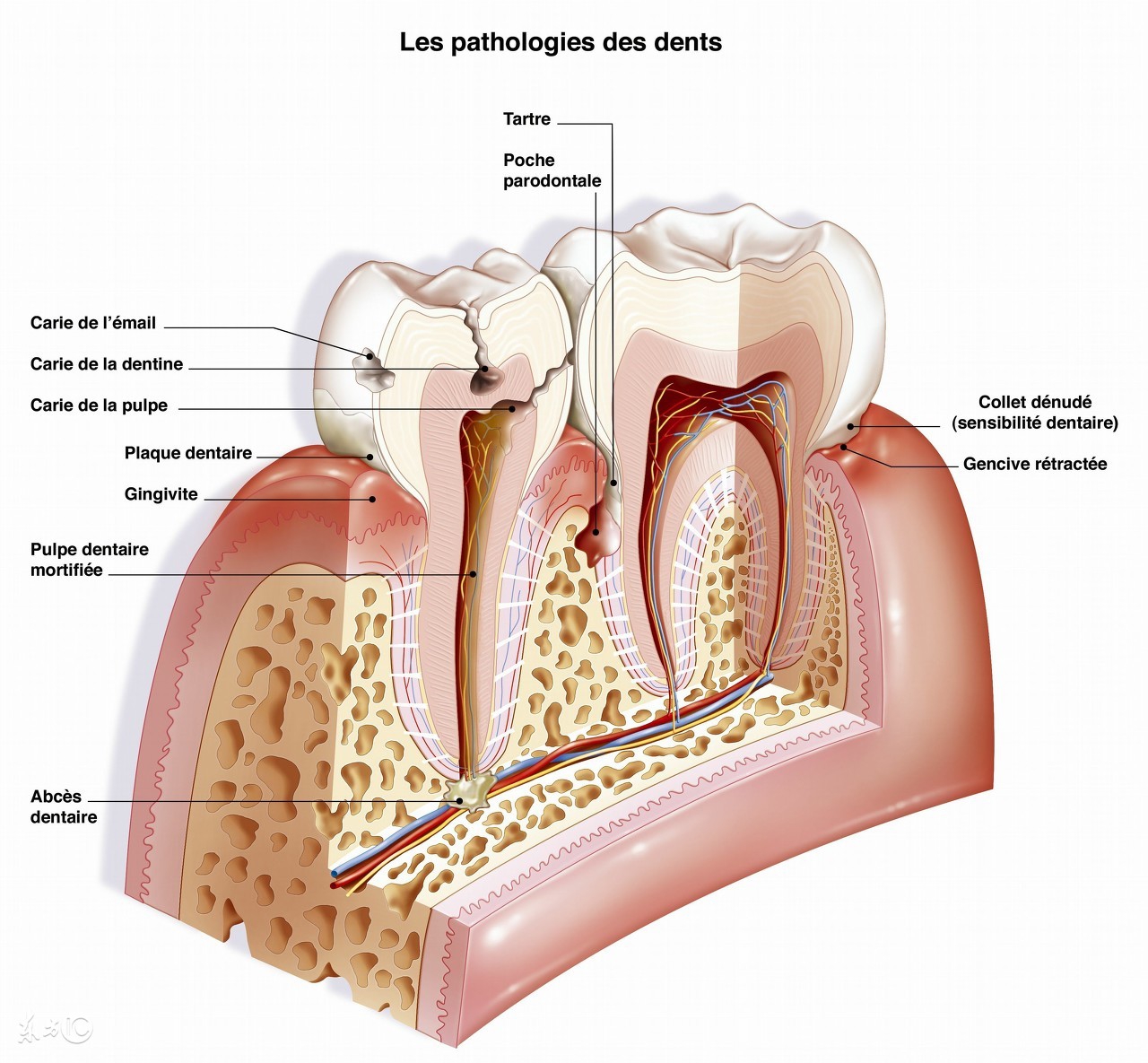 牙龈炎和牙周炎吃什么药比较好,治疗牙龈炎牙周炎牙髓炎的特效药