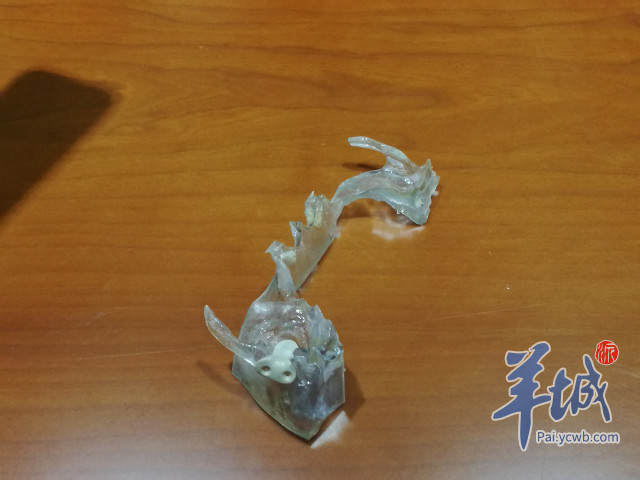 8岁男孩下巴被撞竟导致颅底“破洞”！医生3D打印修复体“补洞”