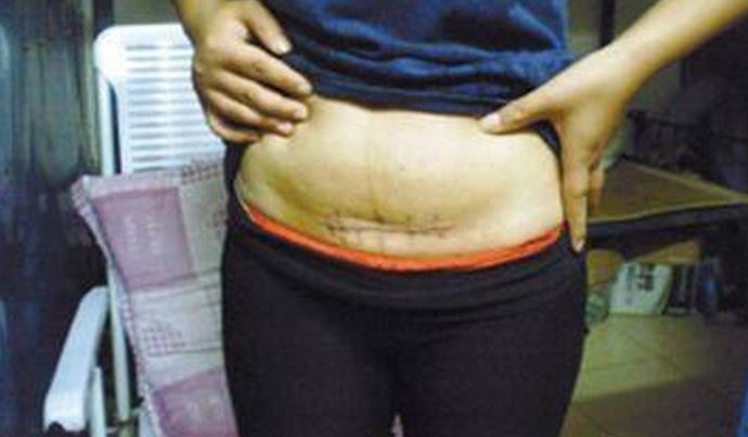 女子带环两年怎么突然怀孕了,女人带环有小孩可以要吗