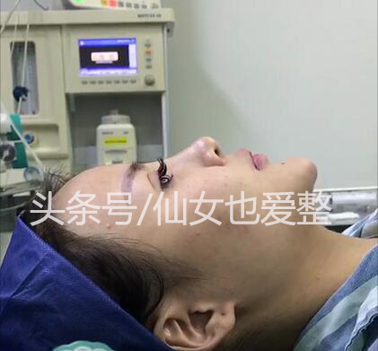 鼻综合隆鼻用什么材料,耳软骨和肋骨隆鼻费用多少钱