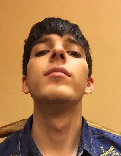 鼻综合隆鼻用什么材料,耳软骨和肋骨隆鼻费用多少钱