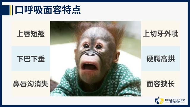 张着嘴巴睡觉会变成什么样,张着嘴睡觉会长成什么样