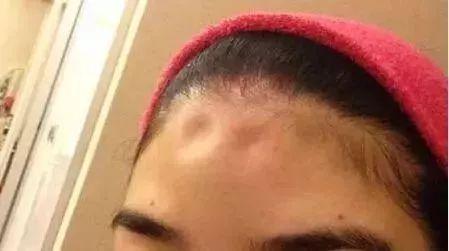 被人砸破脑袋怎么索赔,头被砸索赔