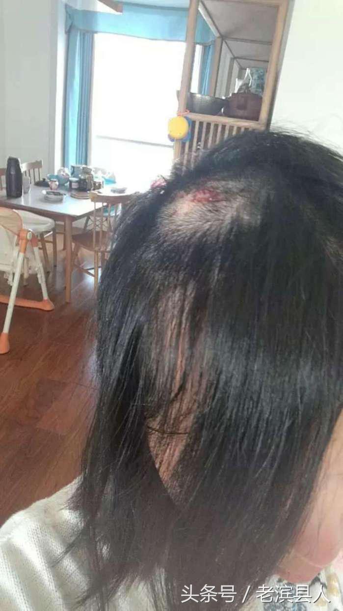 面条机操作起来很危险吗,面条机做出来不圆滑