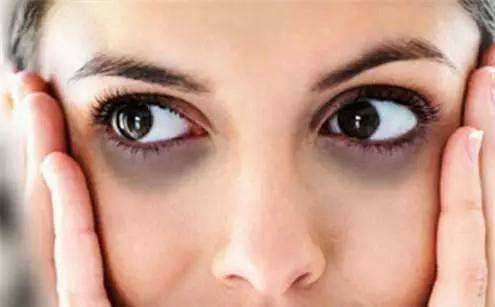 眼霜超贵,眼霜越贵越好吗