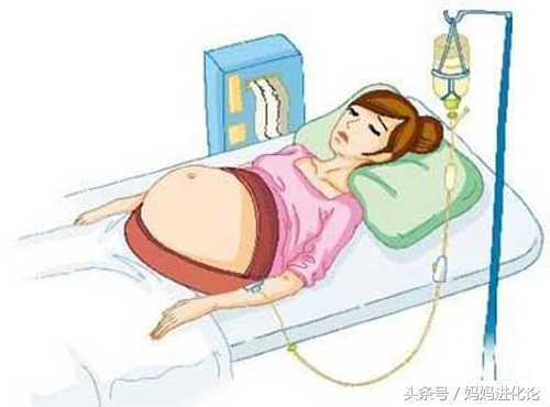 这3种情况需要打催产针,准妈妈你了解吗?