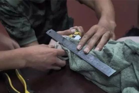 手镯戴不进一招教你轻松取手镯,手镯取不下来教你最后一招