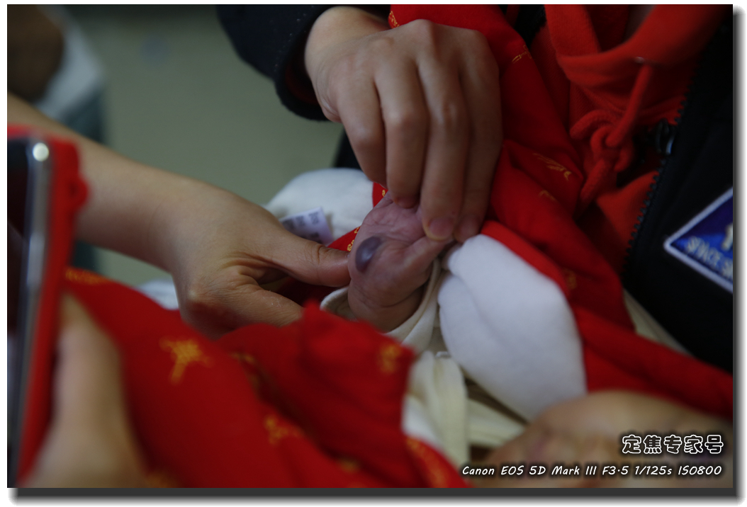 皮肤专家诊室故事连载之五，手心和眉心“开天眼”？