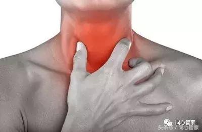 髂动脉支架术后都有什么症状,心脏支架术后最常见的9大症状