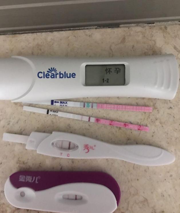 有巧克力囊肿就有子宫内膜异位症,子宫内膜异位症巧克力囊肿致不孕