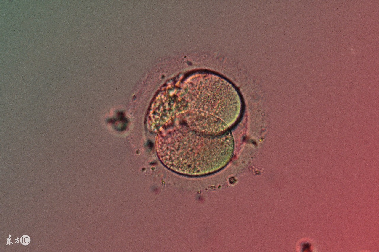 试管婴儿移植后需要注意什么么,试管婴儿移植后注意事项