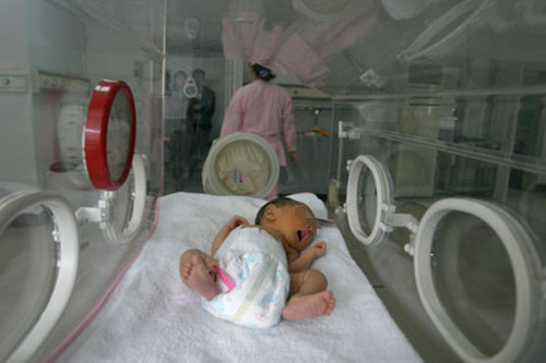 糖尿病脐带绕颈三周几周剖,妊娠期糖尿病脐带绕颈2周