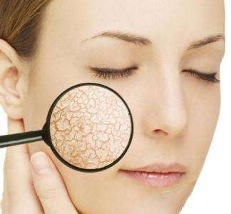 肤质搞不定使用再贵护肤品也浪费,肤质搞不清楚再贵的护肤品也白搭