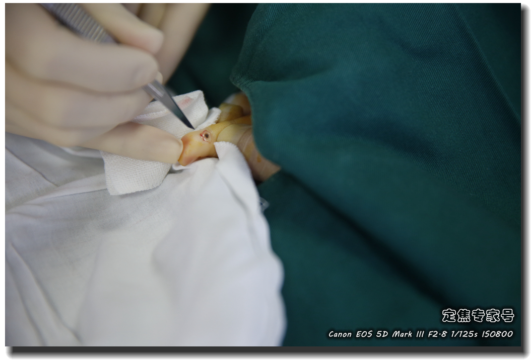 皮肤专家诊室故事连载之五，手心和眉心“开天眼”？