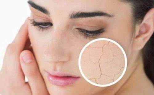 想要肌肤水嫩,混合肌肤用什么乳液最好