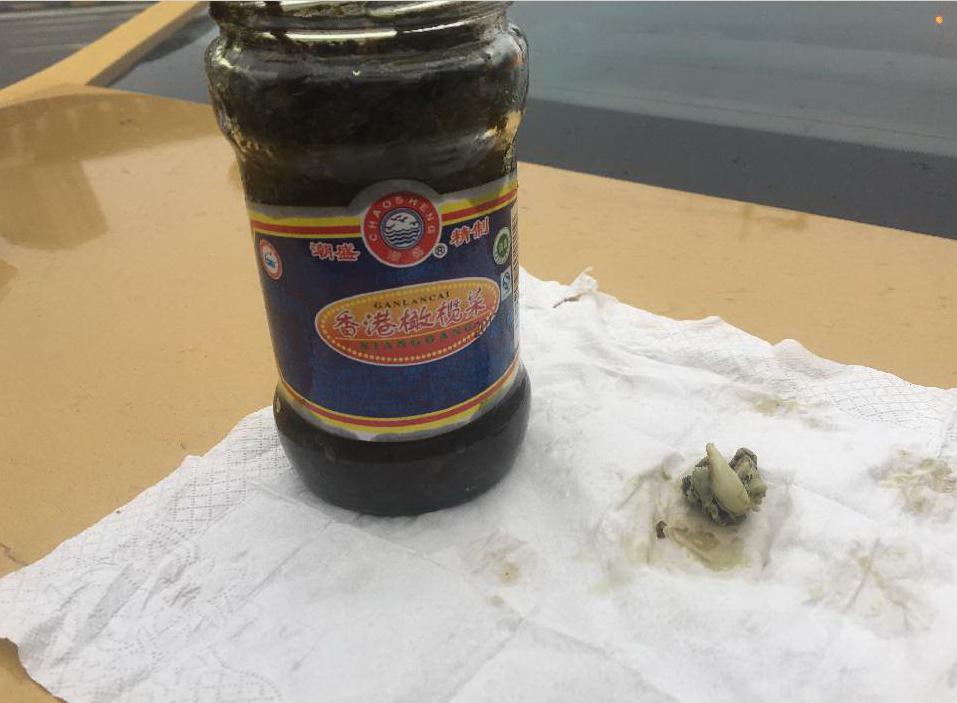 无锡消费者新买橄榄菜里竟有“獠牙”?厂家:怎么证明不是*谤诽**?