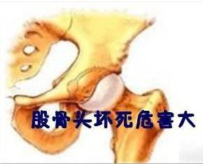 股骨头坏死该如何治疗？给你这三个建议！