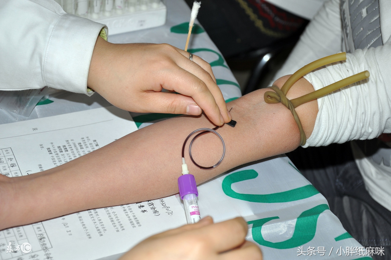 唐氏筛查无创dna和羊水穿刺哪个好,nt3.3做无创dna还是羊水穿刺