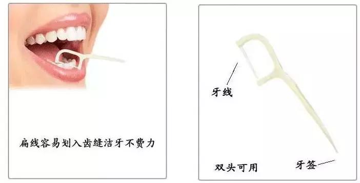 美白牙齿小秘方,美牙仪真的能美白牙齿嘛