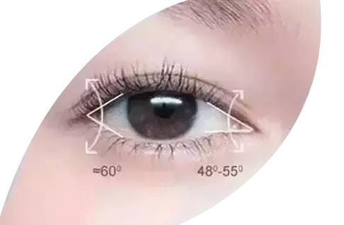 开内眼角攻略,开内眼角都需要了解哪些方面