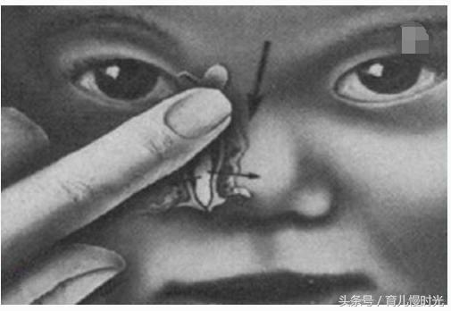 三岁宝宝眼屎多怎么按摩,左眼眼屎多按摩什么穴位去眼屎