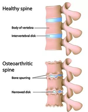 为什么看腰疼医生都按小腿肚,为什么腰椎一按会痛