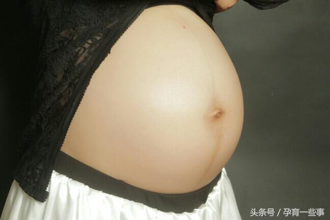 脐带绕颈莫要慌，多数不用剖宫产